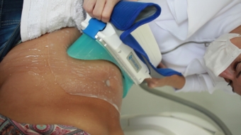 coolsculping-tratamento-corporal