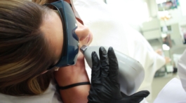 laser-depilacao-buco